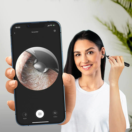 Bebird X0 1080P HD Ear Cleaner - Smart Wax Remover & Visual Otoscope