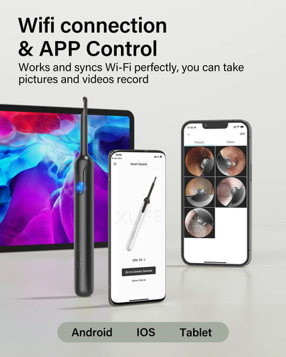 Bebird X0 1080P HD Ear Cleaner - Smart Wax Remover & Visual Otoscope