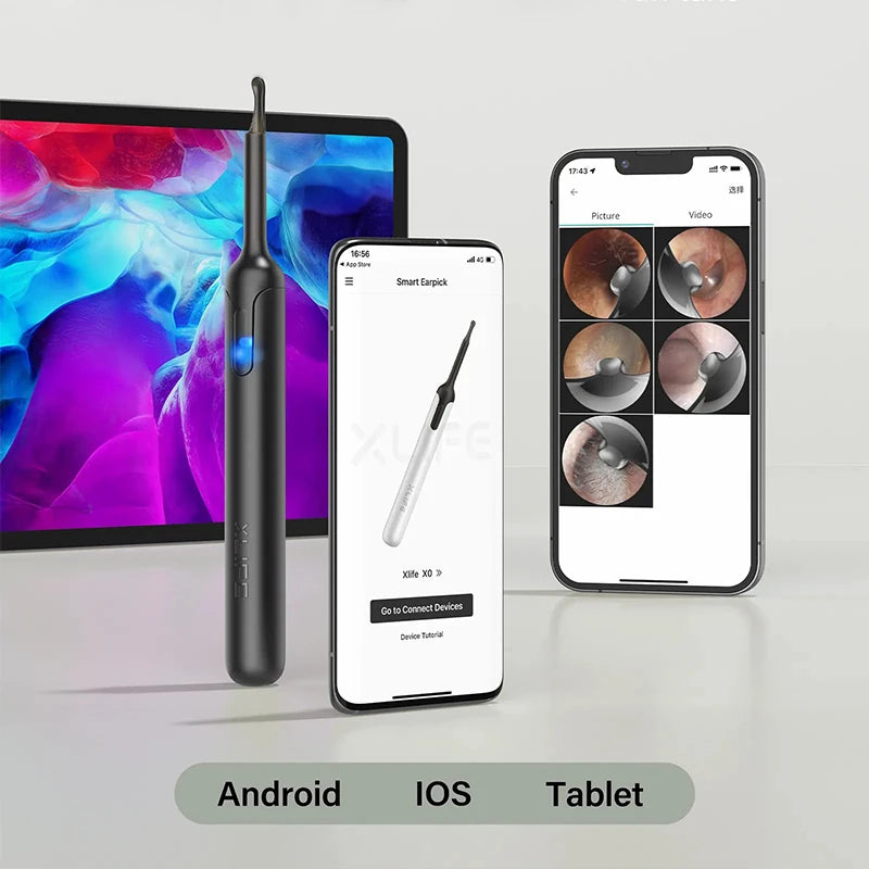Bebird X0 1080P HD Ear Cleaner - Smart Wax Remover & Visual Otoscope