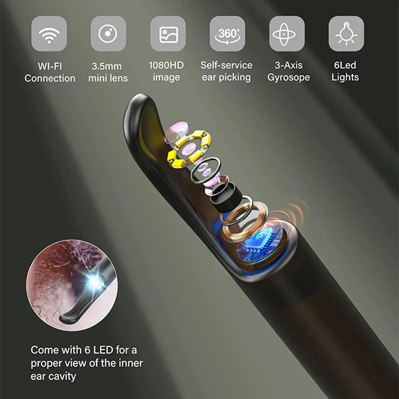 Bebird X0 1080P HD Ear Cleaner - Smart Wax Remover & Visual Otoscope